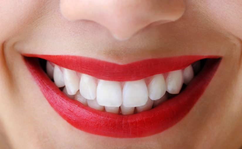 Mennyi ideig tart a fogfehérítés eredménye?